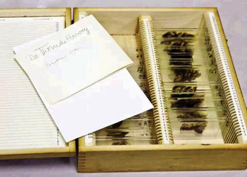 爱因斯坦去世后大脑被人类解剖,爱因斯坦去世后偷走他大脑的人