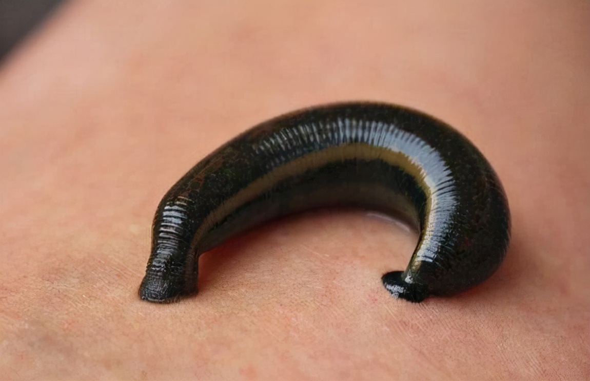 水蛭被人吃进肚子里它能活多久,水蛭被吃到肚子里能活吗