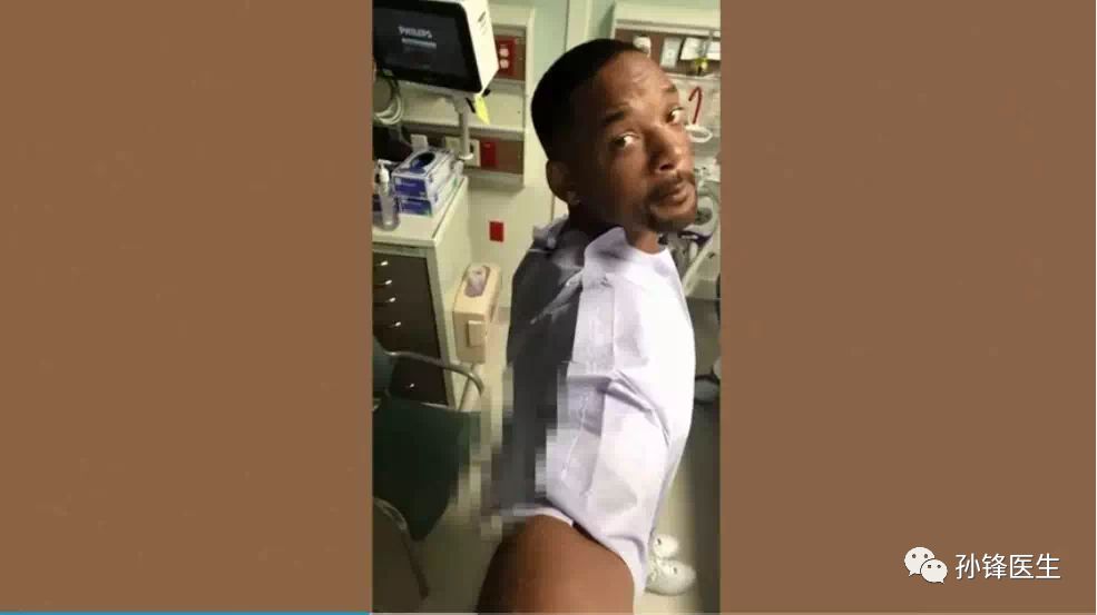 医学干货︱著名影星史密斯做的肠镜检查，竟然跟你发生了关系