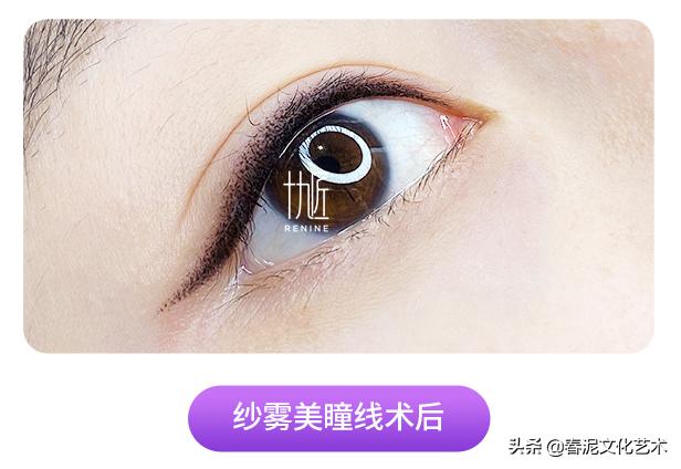 美瞳线怎么去除小妙招,美瞳线发蓝多久能退完