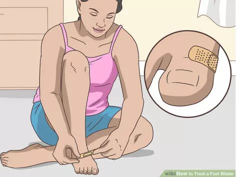 跑步脚上起水泡怎么处理好得快,脚跑步起水泡怎么处理好得快