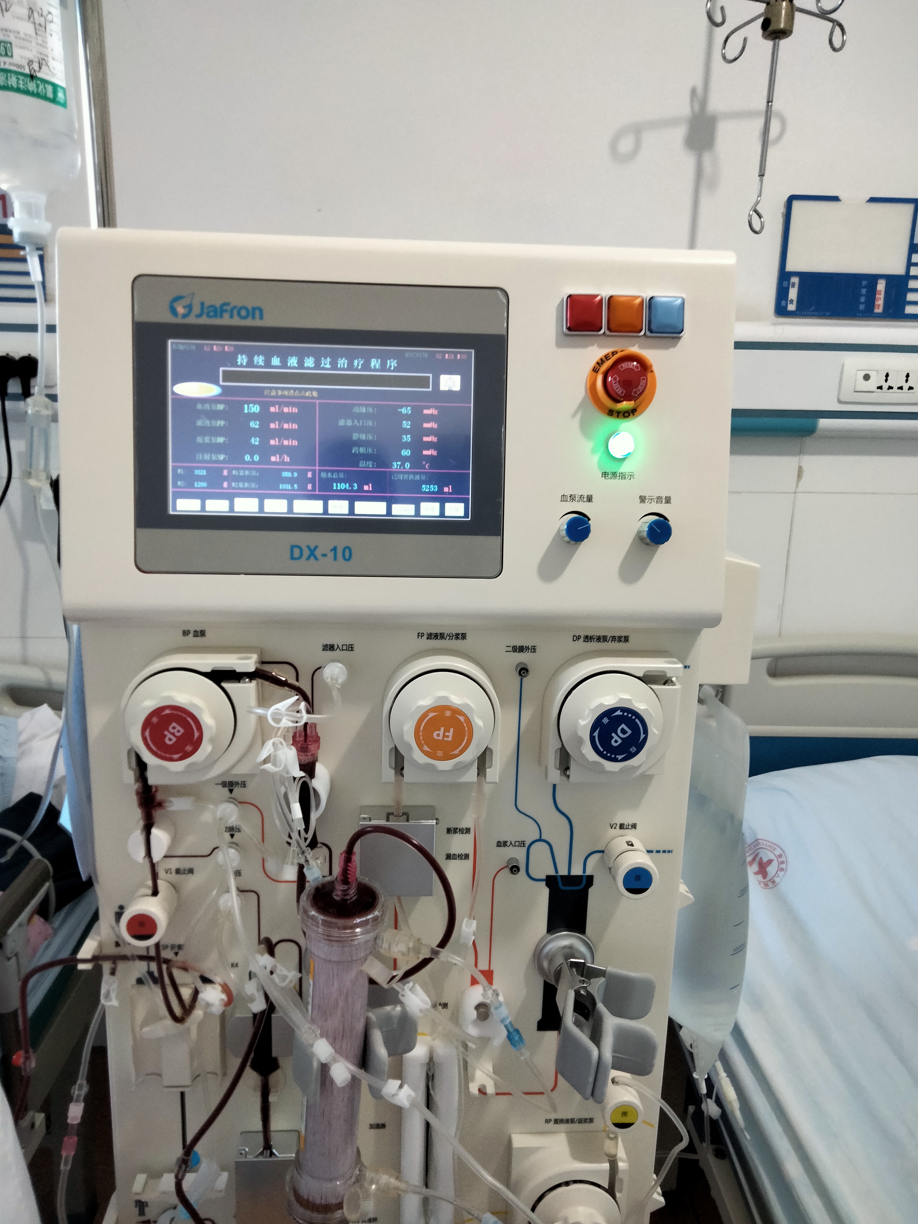 开展crrt治疗,新源县人民医院