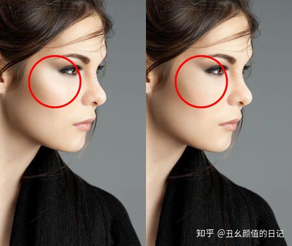 针对三种大饼脸的瘦脸按摩方法,怎么瘦脸解决大小脸