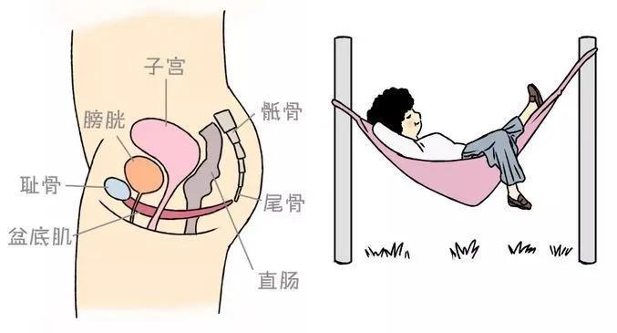 咳嗽漏尿盆腔痛,咳嗽漏尿导致外阴溃烂