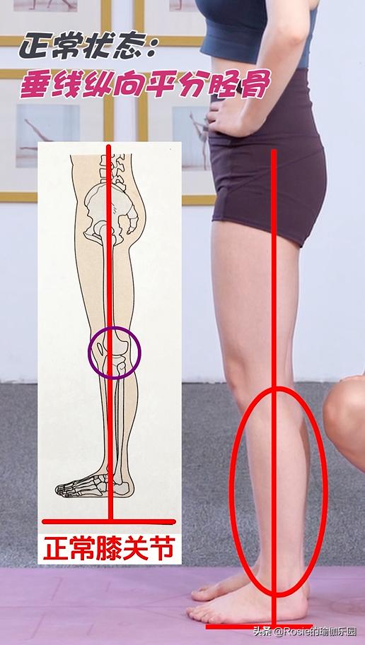 肌肉型小腿粗壮外翻如何变细腿,小腿粗壮如何变细腿健身动作