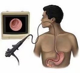 得了胃息肉会得胃癌吗,胃息肉会变成胃癌么