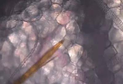 显微镜下的蚊子嘴巴,显微镜下的蚊子吸血全过程