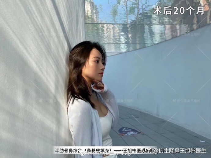 被鼻子封印的颜值,那些被鼻子封印的颜值