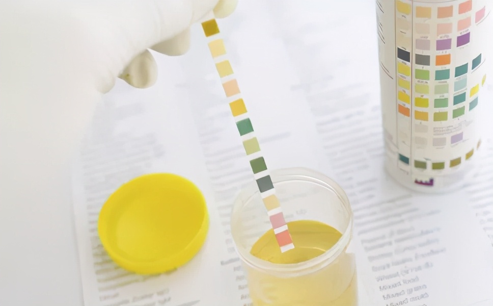 尿常规、血常规各项体检指标代表什么?3分钟教你读懂体检报告