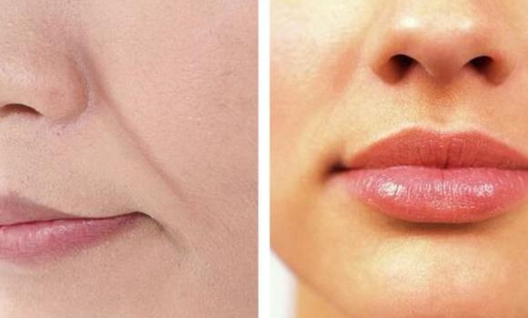 年纪轻轻一笑起来就有法令纹,年纪轻轻法令纹就很明显相学