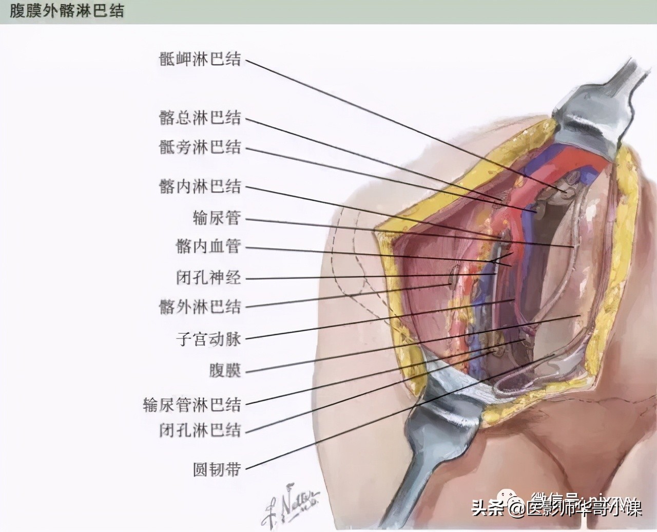 女性盆腔核磁解剖图谱,正常盆腔ct解剖图谱