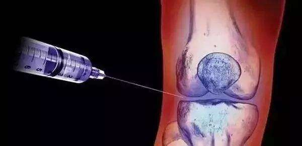 成也激素，败也激素：类风湿治疗中，如何避开激素带来的“陷阱”