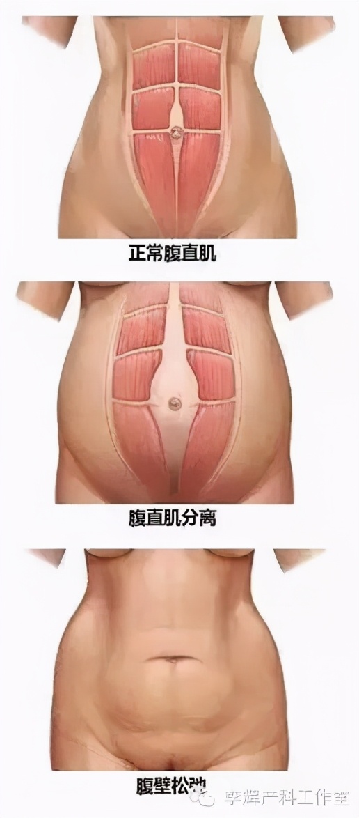 产后42天做盆底康复检查有必要吗,产后42天盆底康复做哪些检查