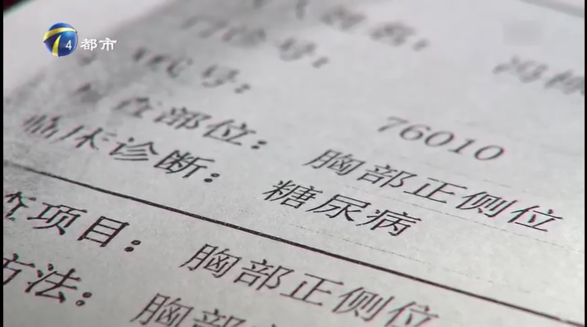 尿里有水纹是糖尿病吗,尿中带泡沫是什么病