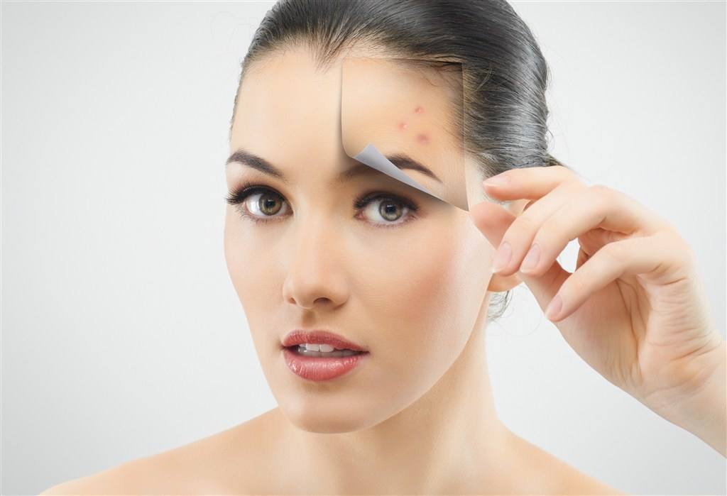 痘痘怎么治都不好不洗脸却好了,痘痘怎么治疗才能彻底治好