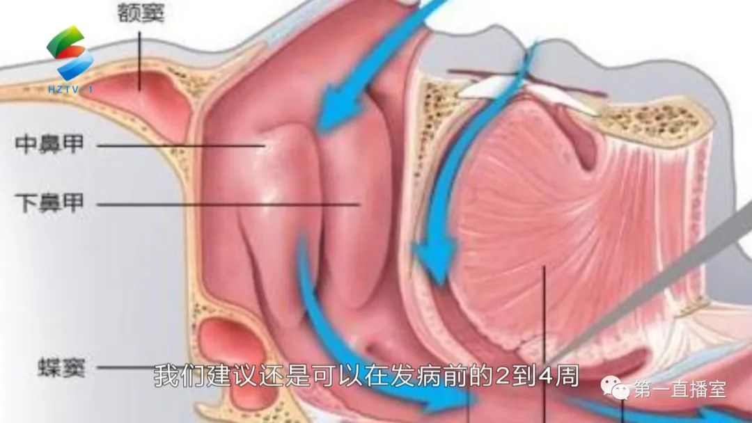 慢性鼻炎的健康宣教,文明始于心安全始于行