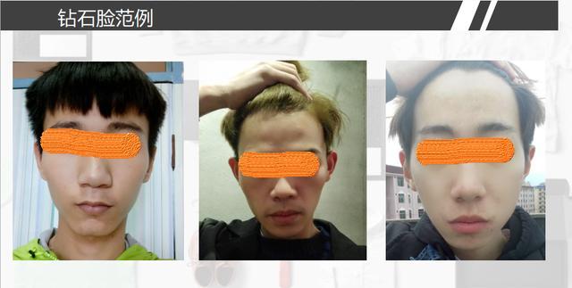 上窄中宽下窄脸型剪什么发型,剪什么发型适合所有脸型