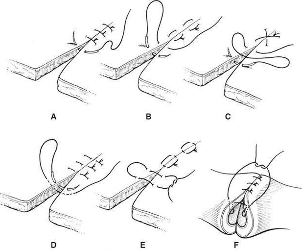 小磕小碰、摔伤烧伤在所难免,不想去医院,在家如何安全处理?