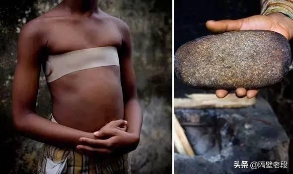 熨平少女胸部！揭秘非洲可怕习俗“烫乳”