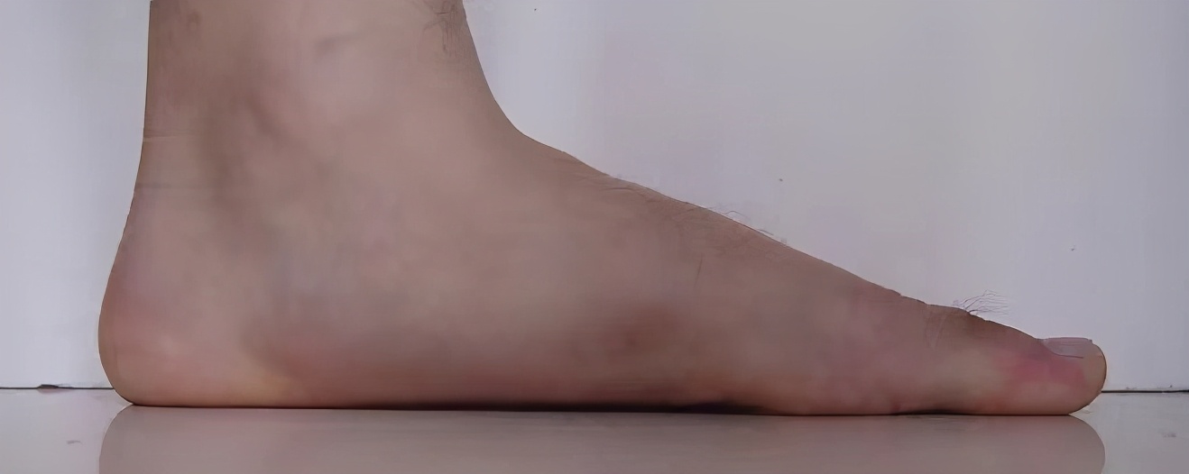 足踝生物力学诊治（足踝生物力学6S中心）