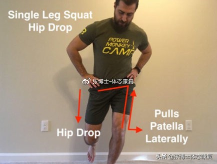 运动康复膝关节疼痛解决,下髌骨关节疼痛综合征