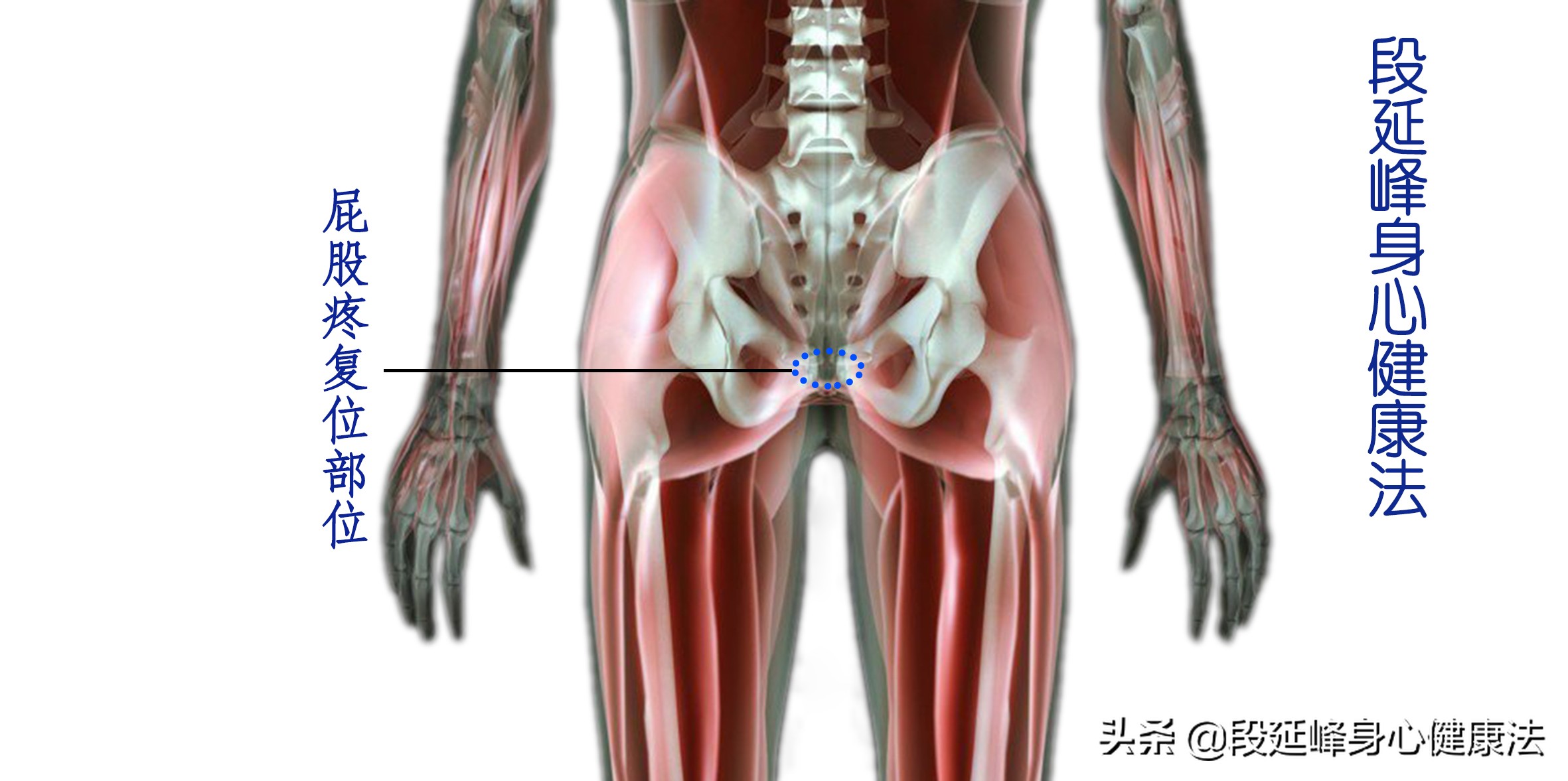 坐着屁股周围一圈酸疼如何缓解,坐着屁股疼腿疼腰疼怎么锻炼