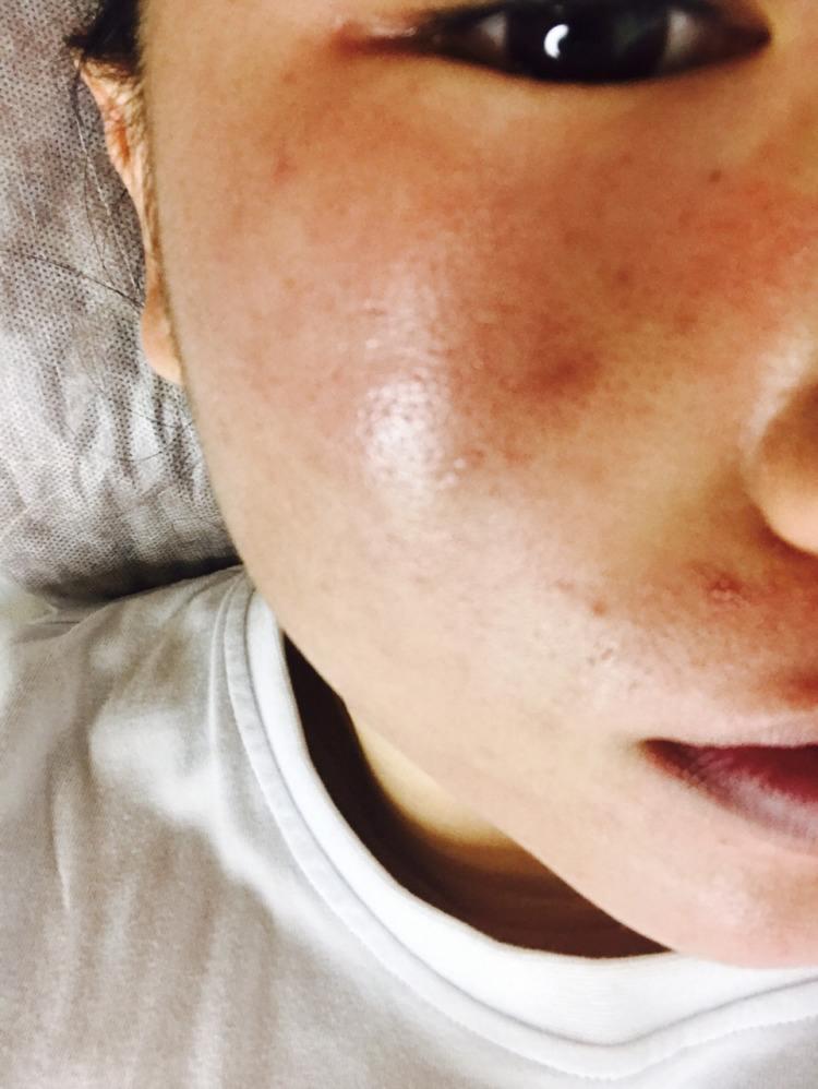 零毛孔让你的皮肤光滑细腻,教你一招搞定毛孔