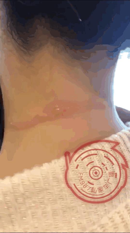 女子烫头发被药水瓶吓懵,福州一女生烫头发