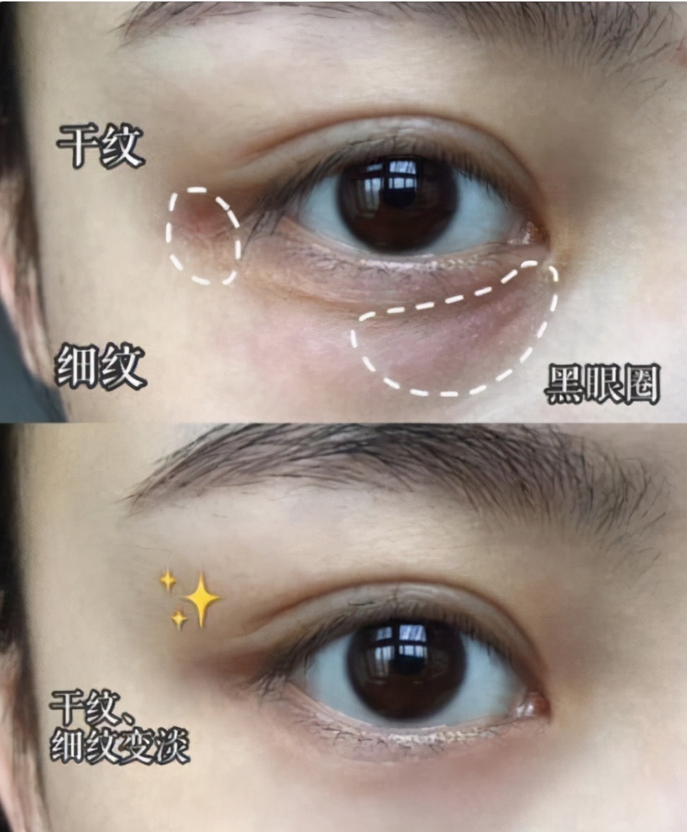 吴昕推荐电动眼霜,吴昕眼霜明星推荐