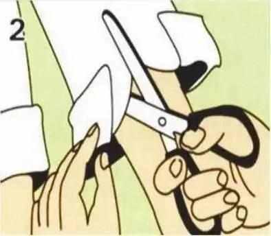 老年烫伤护理教学视频,烫伤的急救护理图文科普