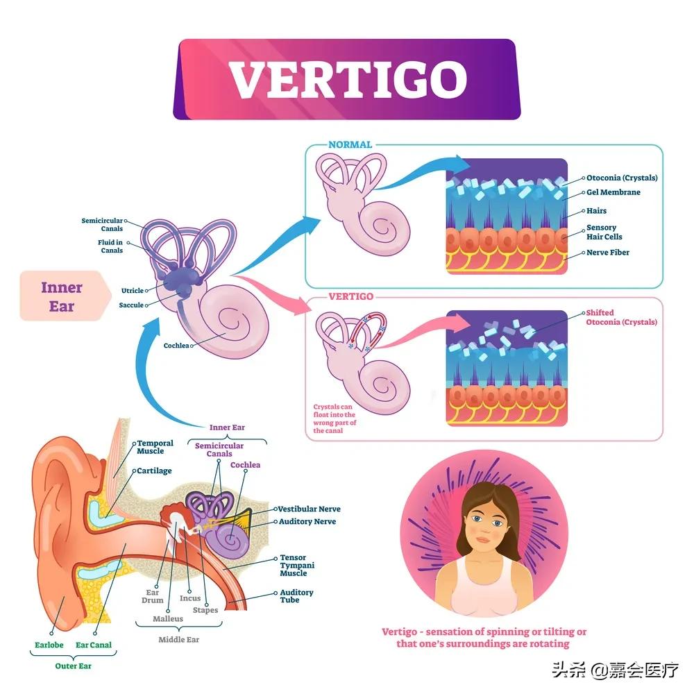 头发昏两眼发蒙,头发昏感觉天旋地转50多岁