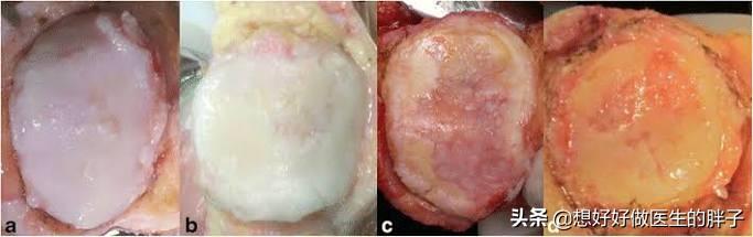 骑自行车膝盖有摩擦的感觉,骑自行车膝盖内侧疼是怎么回事