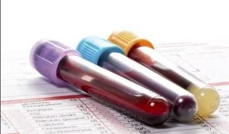 如何远离白血病,要想远离癌症牢记这四字箴言