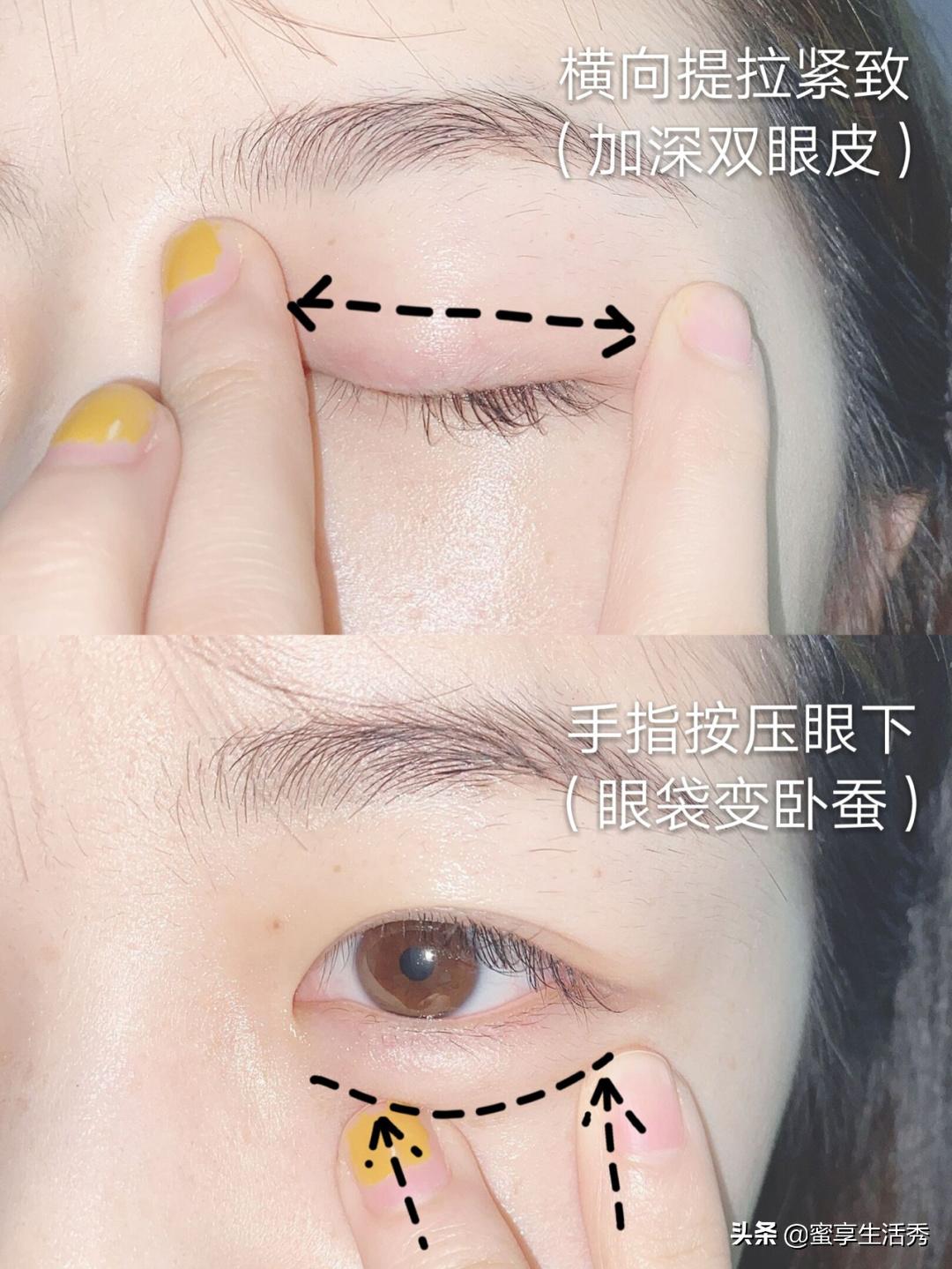 内双眼皮手术变外双效果,内双眼皮怎么变外双按摩最有效