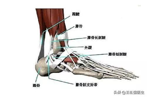 扭到了脚怎么办,扭住脚之后采取什么措施