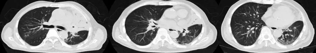 抗菌药物不合理处方分析,抗菌药物用药不合理的表现