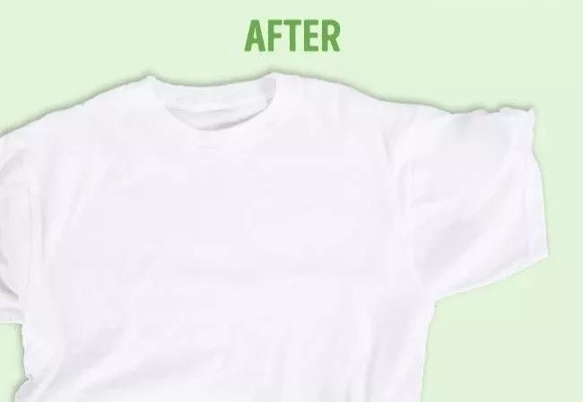 名门泽佳去眼袋红肿结痂图片,名门泽佳去眼袋效果怎么样