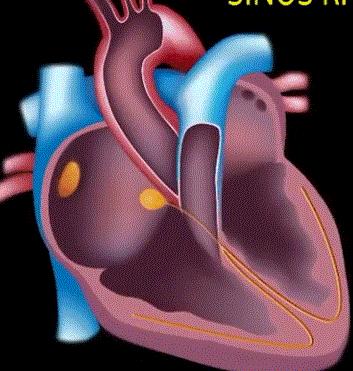 汉中科普：长跑10年，却跑出了心脏病！汉中人你知道正确的运动方式吗？