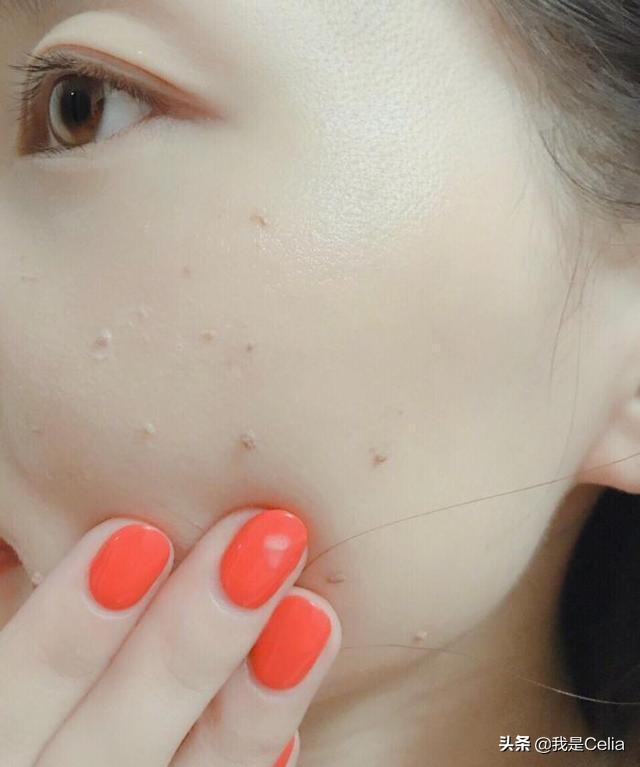 深层清洁毛孔垃圾去角质推荐,清理毛孔去角质产品推荐