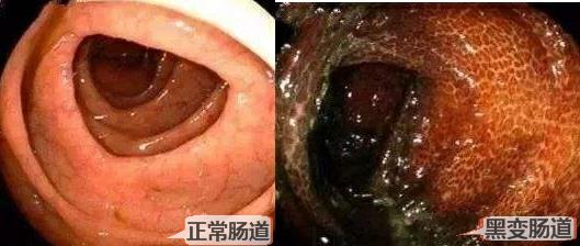 医生开便秘药可以长期吃吗,医生告诉你不能吃什么