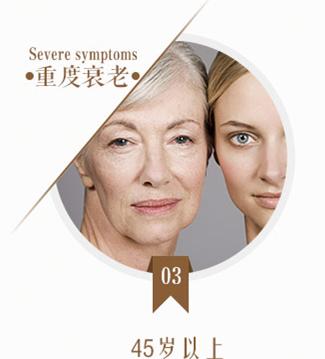 25岁眼角纹严重怎么办能补救吗,25岁眼下细纹怎么去除