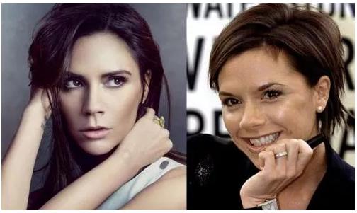 硬刚女皇龙妈也扛不住法令纹,2条沟壑让人心疼,贴一贴就消了