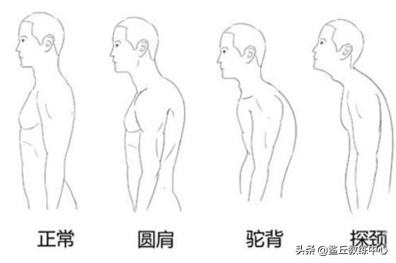 健身私教体态评估纠正,探颈矫正