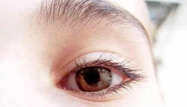 眼部周围为什么一直长脂肪粒,眼下的脂肪粒会有白色小点点