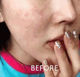 熬夜追《知否》后脸上狂暴痘？这些德国产品可以拯救你的脸！