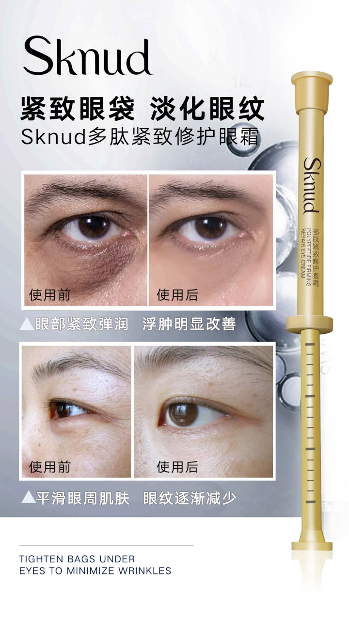 有眼袋怎么办按摩去眼袋,去眼袋眼霜真能去眼袋吗