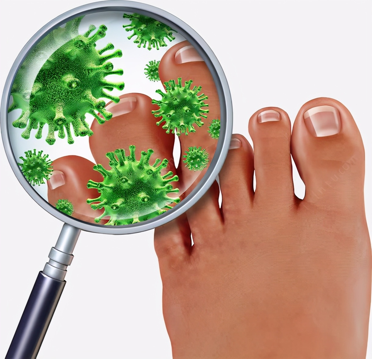 脚气反复奇痒无比,脚气引起全身痒怎么治