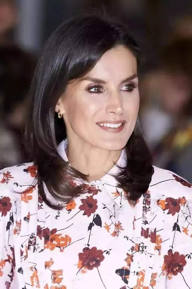 凯特王妃整形了吗,王妃凯特有没有整容