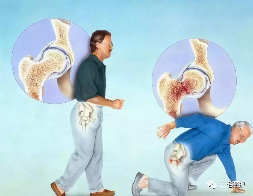 80岁老人腰痛怎么缓解,老人腰痛怎么按摩快速缓解疼痛