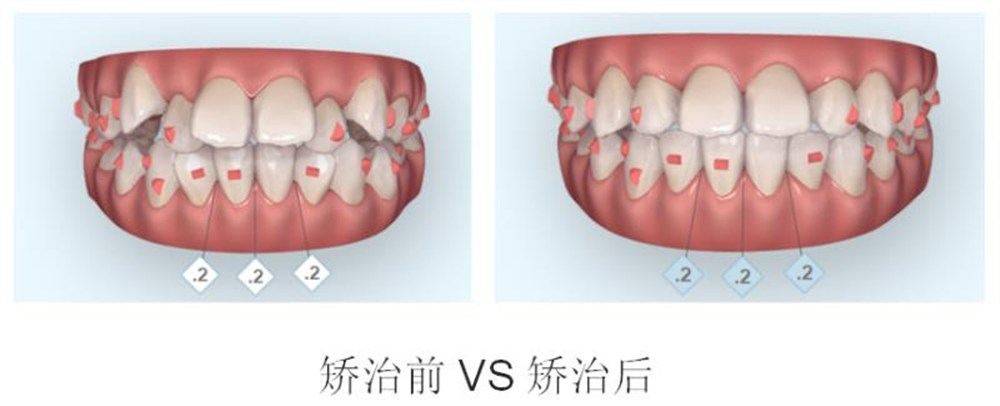儿童医院口腔科看牙,看牙医的小朋友哭了